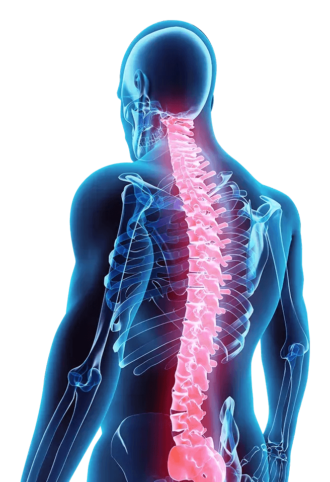 Human anatomy illustration showing common pain regions treated at Chiro-Med Health